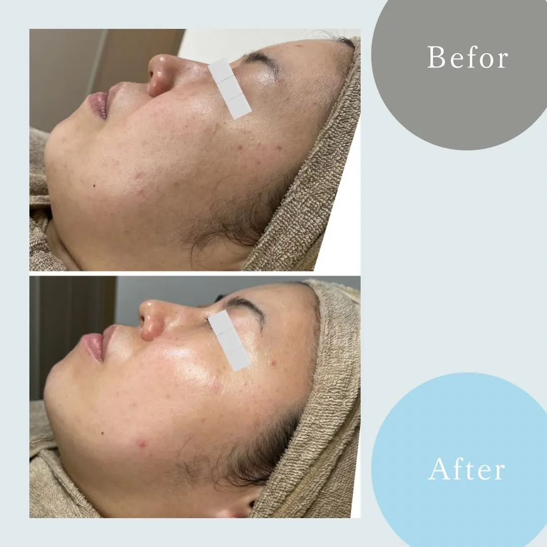 SkincareRoom〜Caaka〜