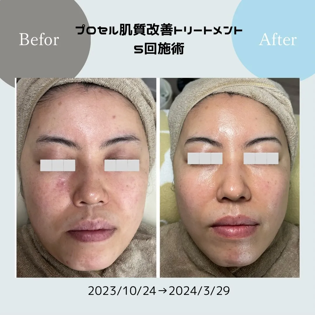 SkincareRoom〜Caaka〜