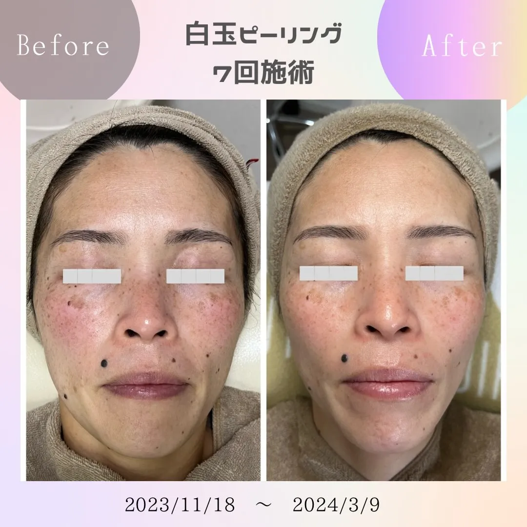 Skincare Room〜Caaka〜